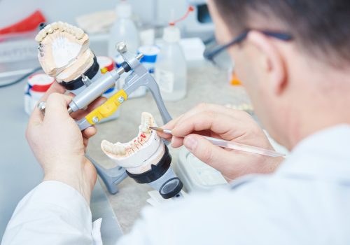 Range of dental prosthetics produced by VDL lab